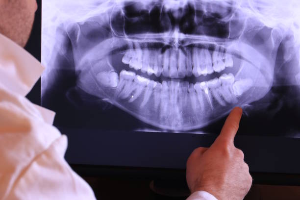 Best Pediatric Emergency Dentist in Menomonee Falls, WI